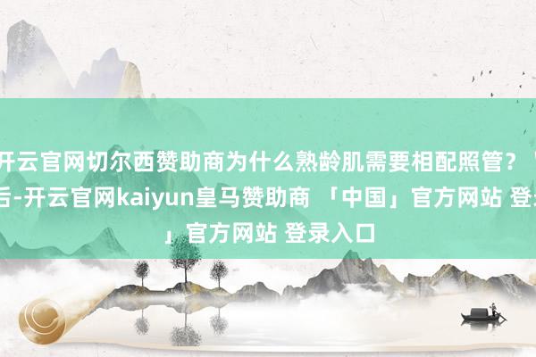 开云官网切尔西赞助商为什么熟龄肌需要相配照管？＂30岁后-开云官网kaiyun皇马赞助商 「中国」官方网站 登录入口